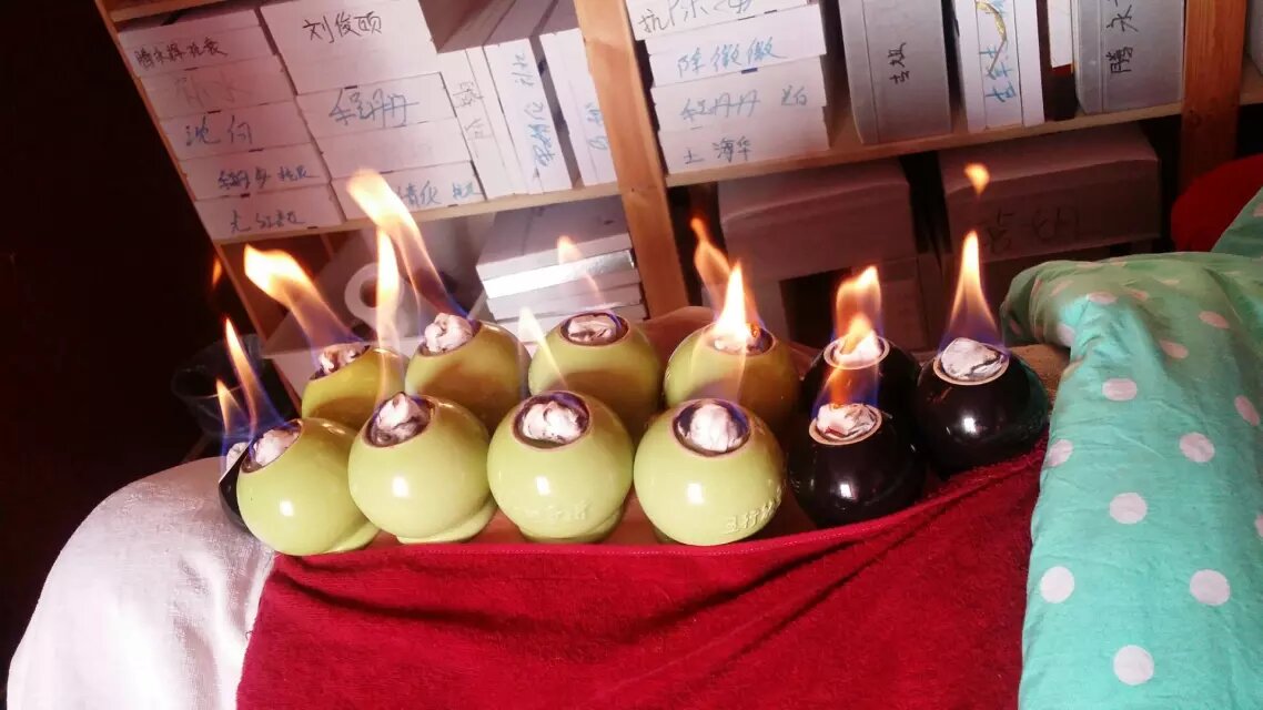 Traditional Cupping Therapy